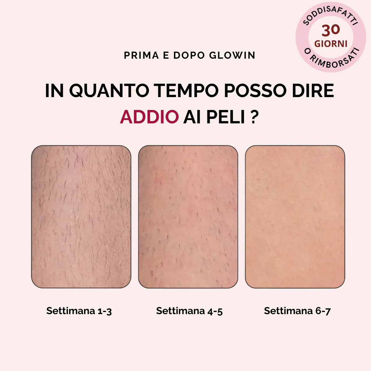 Glowin IPL - Epilatore a Luce Pulsata