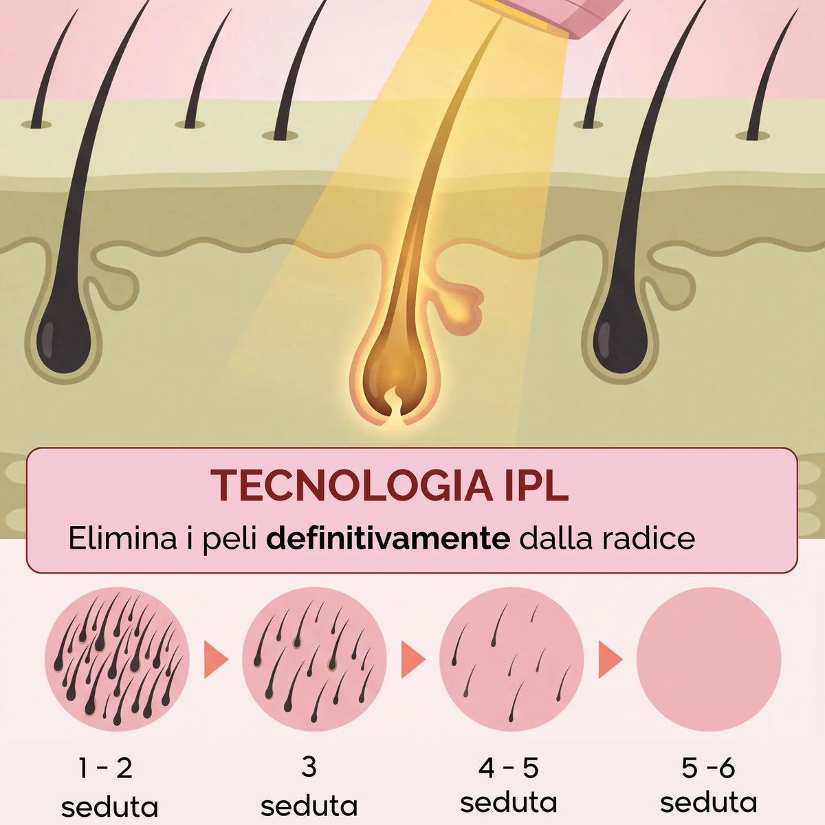 Glowin IPL - Epilatore a Luce Pulsata